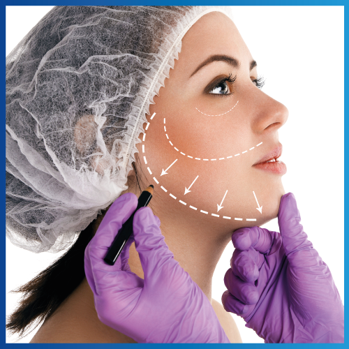 Cirugía  facial